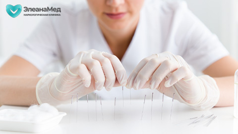 Врач в белых перчатках готовит иглы для акупунктуры